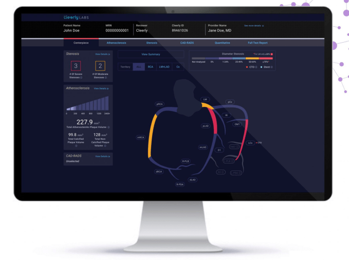 Cleerly Secures $106M Boost for AI-Powered Heart Health Solutions